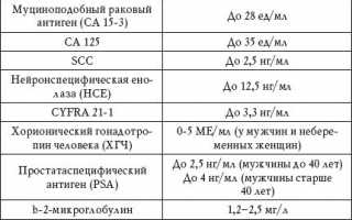 Антиген плоскоклеточной карциномы